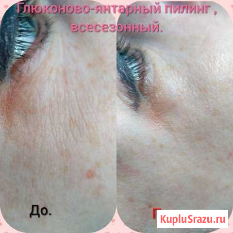 Мастер шугаринга,Косметолог.Красноармейский Волгоград - изображение 1