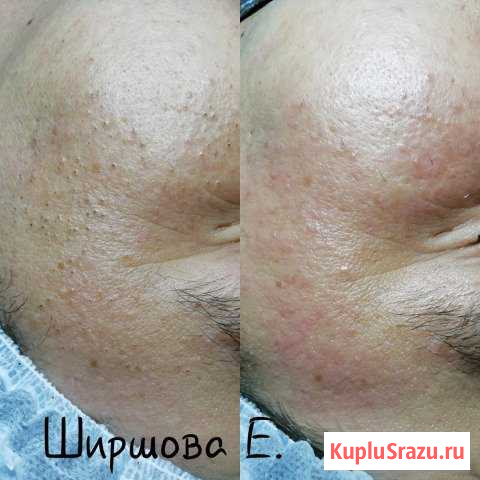 Косметолог Краснодар - изображение 1