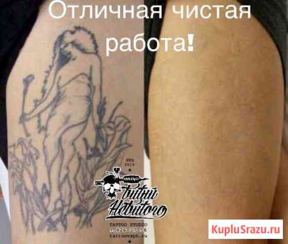 Удаление Тату Лазером спб Санкт-Петербург