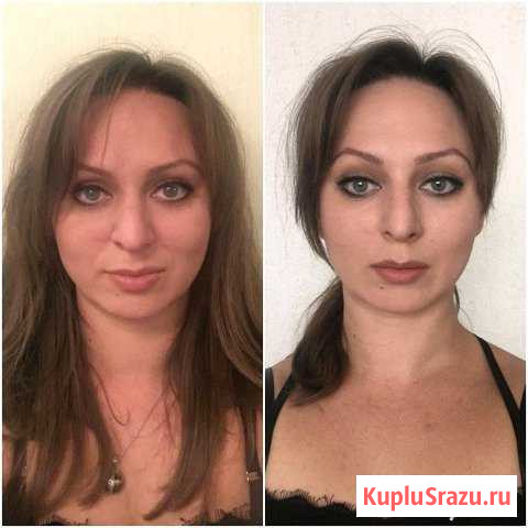 Тейпирование лица Новосибирск - изображение 1