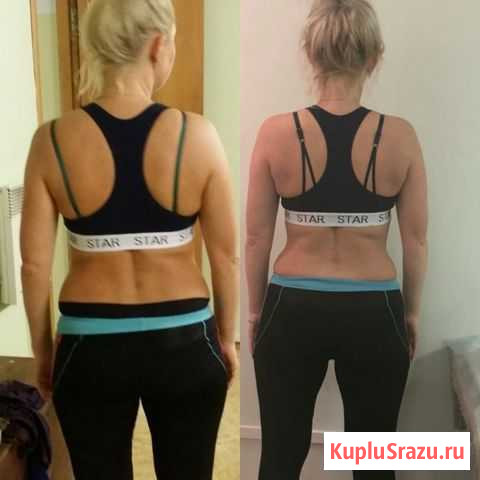 LPG массаж Владивосток - изображение 1