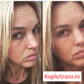 Instantly Ageless крем замена ботоксу Йошкар-Ола - изображение 1