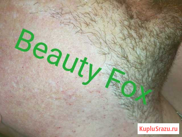 Эпиляция в салоне красоты муж./жен 100 Москва - изображение 1