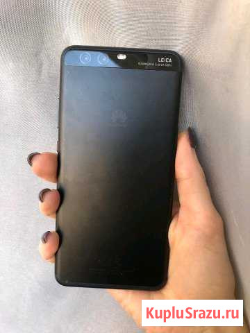 Huawei p10 plus Мосрентген - изображение 1