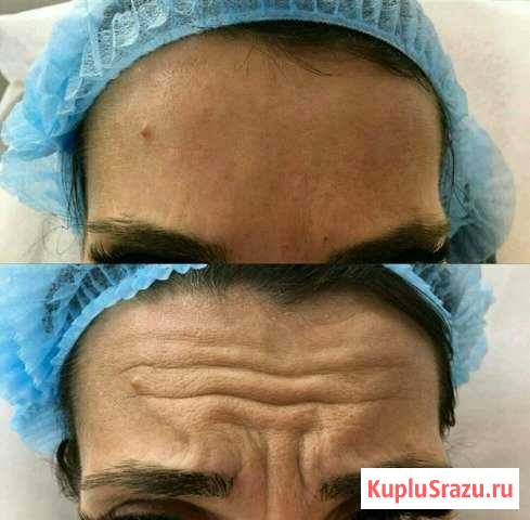 Косметолог Москва - изображение 1