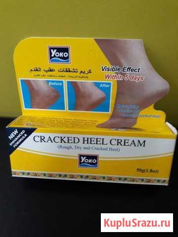 Крем от трещин на ступнях и пятках Калуга - изображение 1