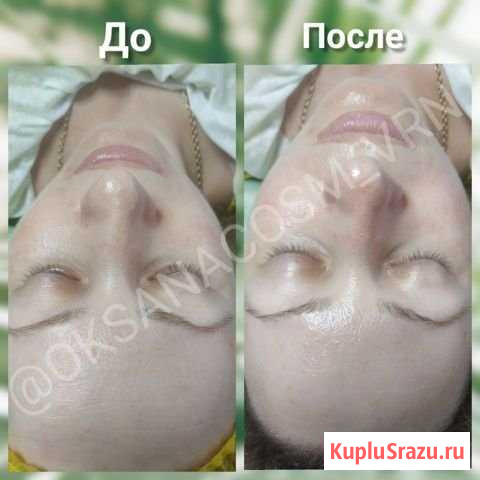 Косметолог р-н Цирка Воронеж - изображение 1