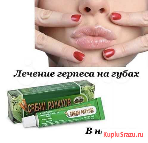 Крем от герпеса Таиланд Ханты-Мансийск - изображение 1