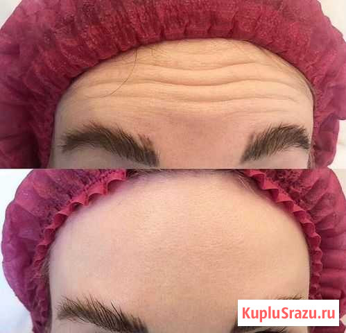 Косметолог Краснодар - изображение 1