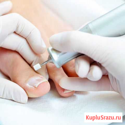 Гигиенический педикюр Выборг - изображение 1