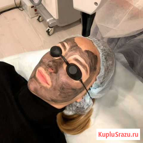 Лазерное удаление Елец - изображение 1