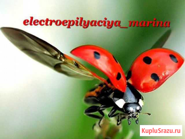 Электроэпиляция Дербент - изображение 1