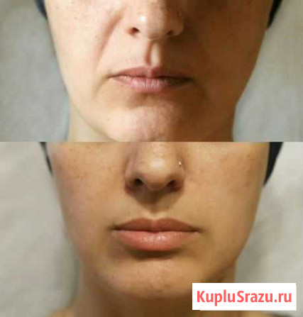 Косметолог Санкт-Петербург - изображение 1