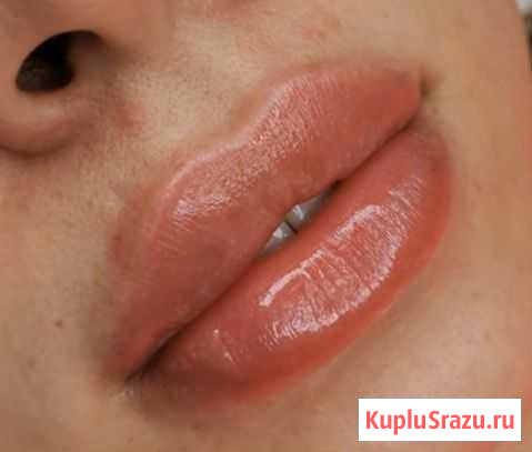 Косметолог Махачкала - изображение 1