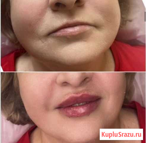 Косметолог/шугаринг Волгоград - изображение 1