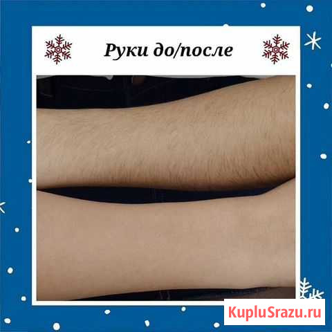 Шугаринг, ваксинг, эпиляция Волгоград - изображение 1