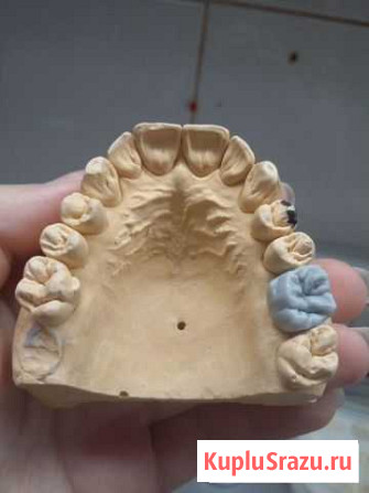 Услуги зубного техника Москва - изображение 1