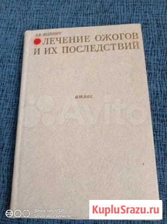 Атлас лечения ожогов и их последствий Юденич Воскресенское - изображение 1