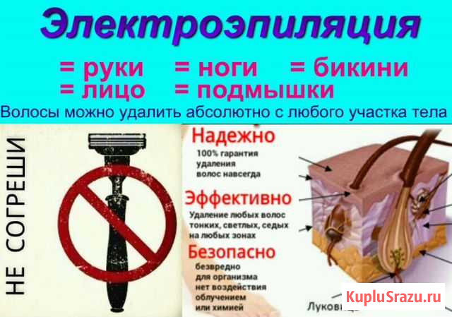 Электроэпиляция на дому. Тушино Москва - изображение 1