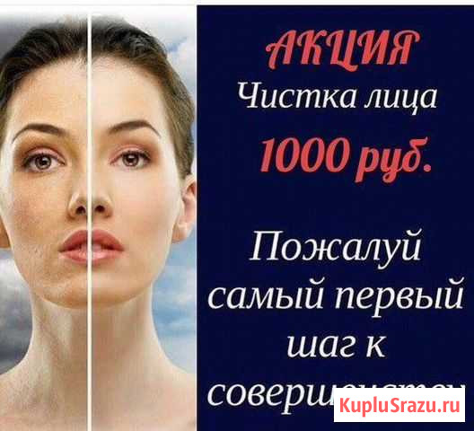 Депиляция Новокузнецк - изображение 1