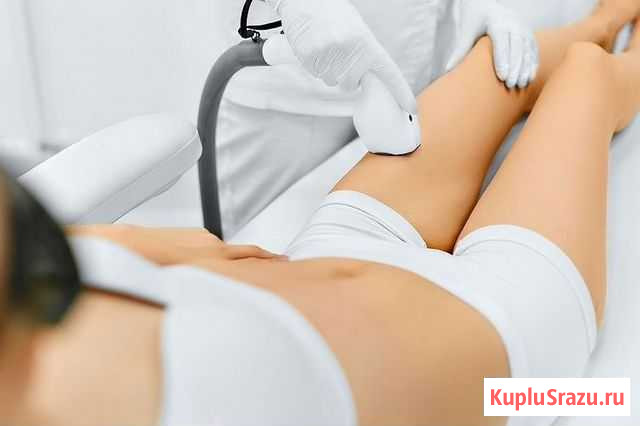 Лазерная эпиляция Калининград - изображение 1