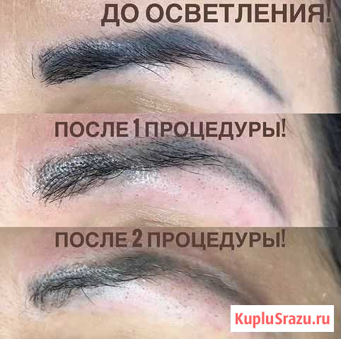Удаление татуажа Краснодар - изображение 1