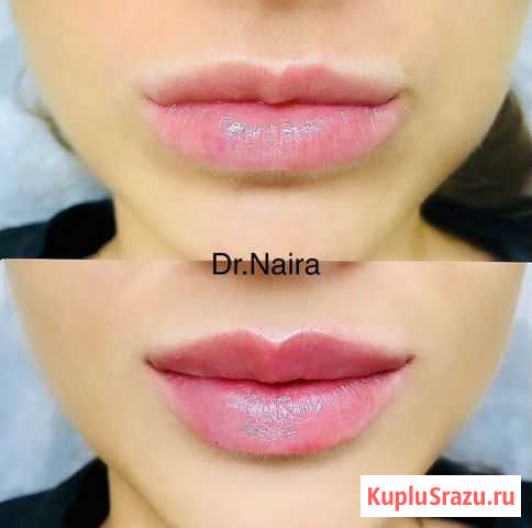 Косметология Москва - изображение 1