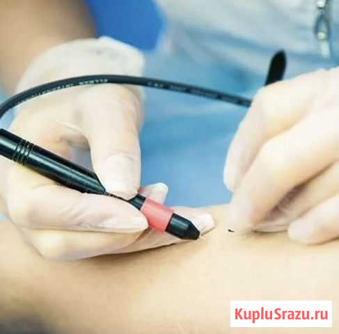 Электроэпиляция Калуга - изображение 1