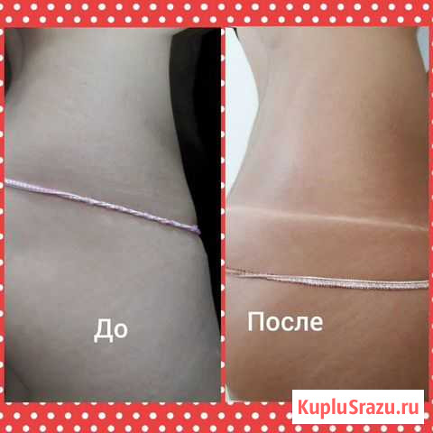 Моментальный загар Нижний Новгород - изображение 1