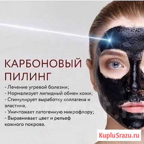 Карбоновый пилинг Петропавловск-Камчатский - изображение 1