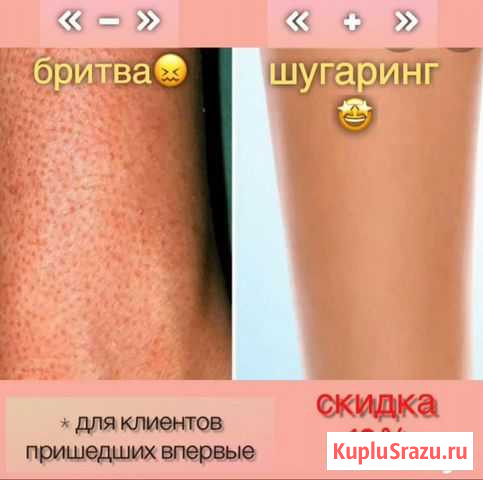 Услуга шугаринга и массажа Тольятти - изображение 1