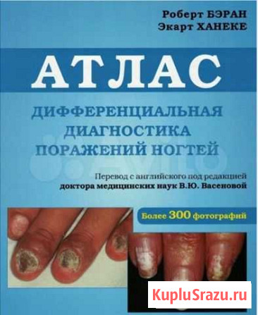 Атлас дифференциальная диагностика поражения ногте Волгоград - изображение 1