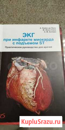 Экг при инфаркте миокарда с подъёмом ST Калининград - изображение 1