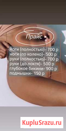 Шугаринг Обнинск - изображение 1