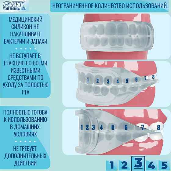 FFT / Капа стоматологическая для зубов и десен, отбеливания / реминерализации зубов, силиконовая, мя 