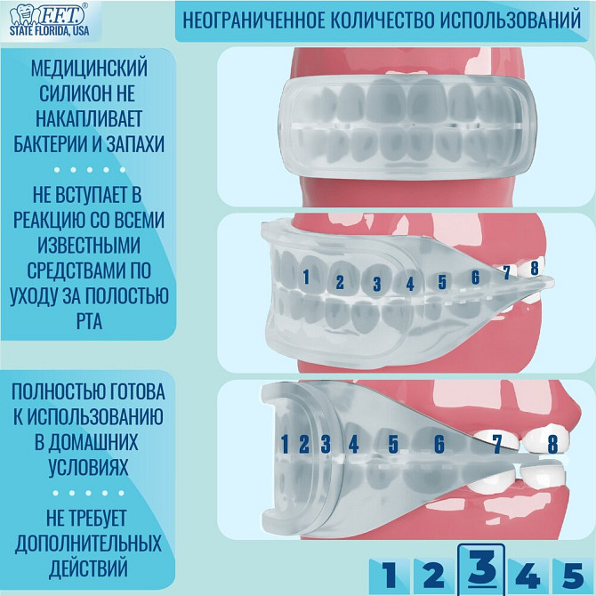 FFT / Капа стоматологическая для зубов и десен, отбеливания / реминерализации зубов, силиконовая, мя  - изображение 3